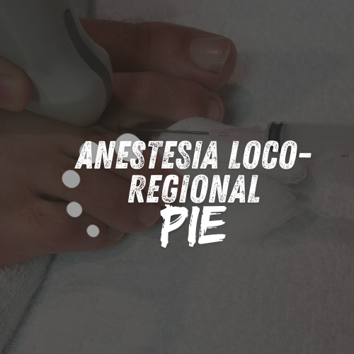 Anestesia Loco-Regional del Pie